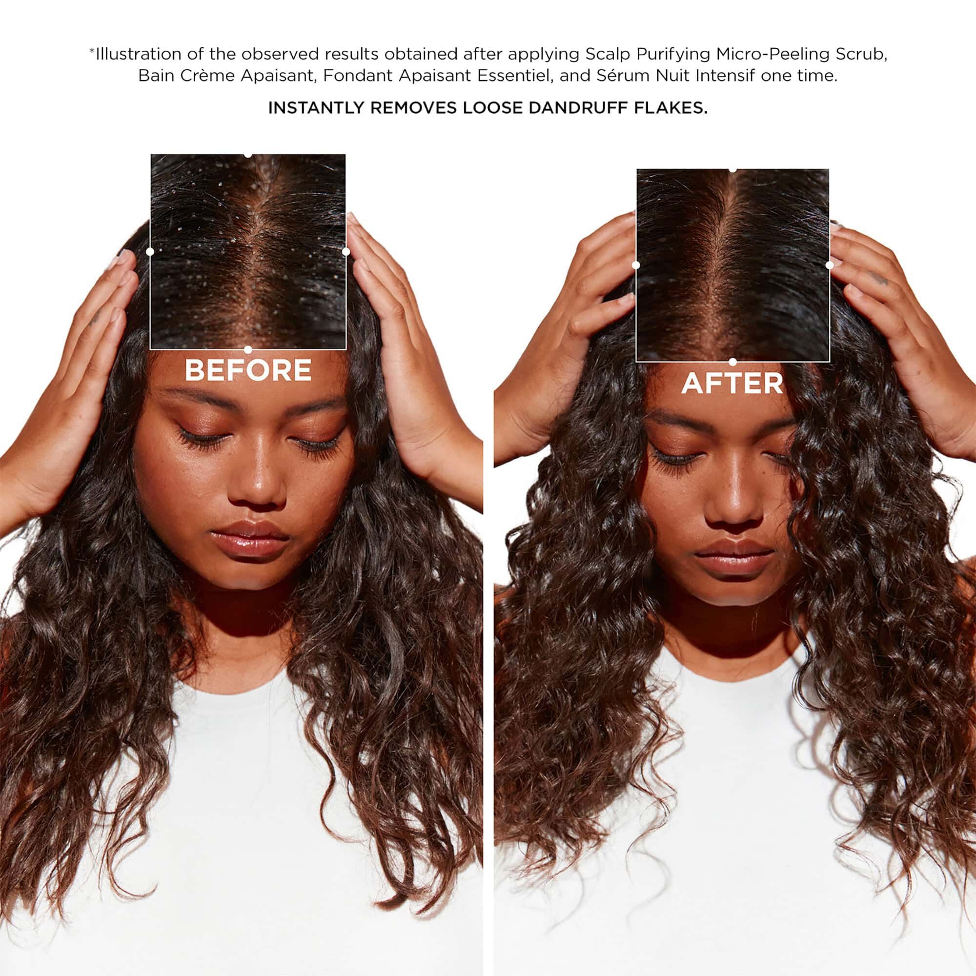 Scalp Purifying Micro-Peeling Scrub 200ml